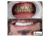 مركز الكرمل لطب الاسنان— د.اسامه يونس زلوم Image 2
