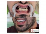 مركز الكرمل لطب الاسنان— د.اسامه يونس زلوم Image 3