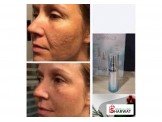 Cellular rejuvenation serum سيروم الليمونيس: Image 3