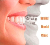 Smiles Dental clinic